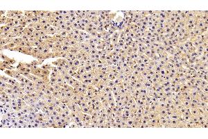 Detection of FASN in Rat Liver Tissue using Polyclonal Antibody to Fatty Acid Synthase (FASN) (Fatty Acid Synthase anticorps  (AA 2263-2512))