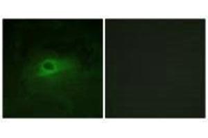 Immunofluorescence analysis of HeLa cells, using CSFR (Ab-809) antibody. (CSF1R anticorps  (Tyr809))