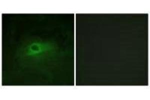 Immunofluorescence analysis of HeLa cells, using CSFR (Ab-809) antibody.