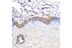 Immunohistochemistry of paraffin-embedded human esophageal using Ferritin Light Chain Rabbit mAb (ABIN7267170) at dilution of 1:100 (40x lens). (FTL anticorps)