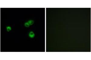 Immunofluorescence analysis of MCF-7 cells, using OR7E5P Antibody. (OR7E5P anticorps  (AA 35-84))