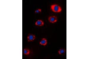 Immunofluorescent analysis of RPS12 staining in Hela cells.