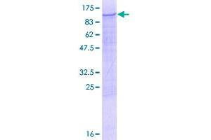 Image no. 1 for phosphofructokinase, Muscle (PFKM) protein (GST tag) (ABIN1314749)