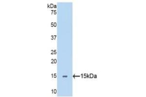 Detection of Recombinant SEMA5B, Human using Polyclonal Antibody to Semaphorin 5B (SEMA5B) (SEMA5B anticorps  (AA 36-161))