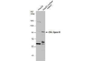WB Image HepG2 whole cell and nuclear extracts (30 μg) were separated by 7. (LIG3 anticorps  (C-Term))