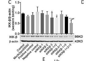 Effects of paeonol on IKK-β in LPS-induced RAW264.