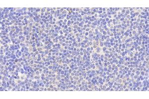 Detection of PTPN22 in Human Lymph node Tissue using Polyclonal Antibody to Protein Tyrosine Phosphatase, Non Receptor Type 22 (PTPN22)