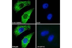 (ABIN184952) Immunofluorescence analysis of paraformaldehyde fixed HeLa cells, permeabilized with 0. (ALMS1 anticorps  (C-Term))