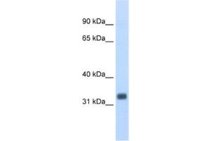 Western Blotting (WB) image for anti-Ets Homologous Factor (EHF) antibody (ABIN2462031) (EHF anticorps)