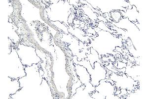 (ABIN185099) Negative Control showing staining of paraffin embedded Human Lung, with no primary antibody.