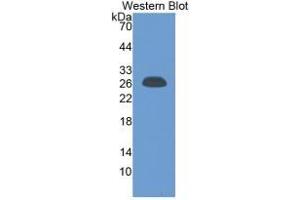 WB of Protein Standard: different control antibodies against Highly purified E. (CRP Kit CLIA)