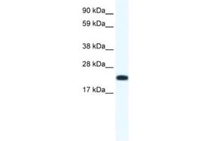 Western Blotting (WB) image for anti-Cbp/p300-Interacting Transactivator, with Glu/Asp-Rich Carboxy-terminal Domain, 4 (CITED4) antibody (ABIN2461495) (CITED4 anticorps)