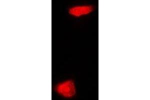 Immunofluorescent analysis of PHYHD1 staining in MCF7 cells.
