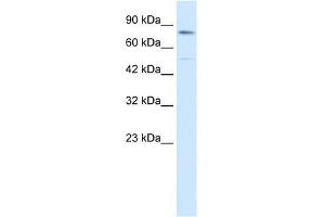 Human HepG2; WB Suggested Anti-ZNF341 Antibody Titration: 0. (ZNF341 anticorps  (Middle Region))