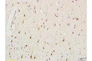 Formalin-fixed and paraffin embedded: rat brain tissue labeled with Anti-CK2 Polyclonal Antibody , Unconjugated at 1:200, followed by conjugation to the secondary antibody and DAB staining