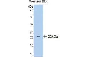 Detection of Recombinant IL18BP, Rat using Polyclonal Antibody to Interleukin 18 Binding Protein (IL18BP) (IL18BP anticorps  (AA 29-193))