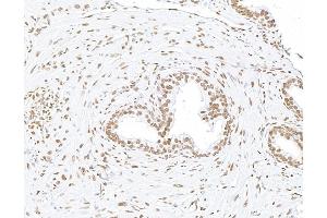 Immunohistochemistry (IHC) image for anti-Matrin 3 (MATR3) (C-Term) antibody (ABIN7455225)