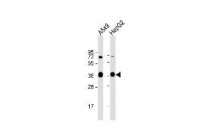 All lanes : Anti-AKR1C3 Antibody (Center) at 1:1000 dilution Lane 1: A549 whole cell lysate Lane 2: HepG2 whole cell lysate Lysates/proteins at 20 μg per lane.