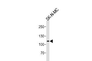 Western blot analysis of lysate from SK-N-MC cell line, using NOC3L Antibody (N-term) (ABIN657897 and ABIN2846849).
