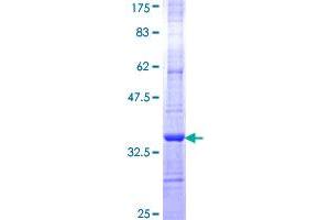 Image no. 1 for Galactosylceramidase (GALC) (AA 596-669) protein (GST tag) (ABIN1354708)