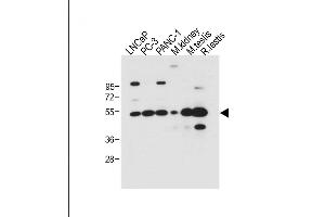 All lanes : Anti-DMRT3 Antibody (C-term) at 1:500 dilution Lane 1: LNCaP whole cell lysate Lane 2: PC-3 whole cell lysate Lane 3: NC-1 whole cell lysate Lane 4: Mouse kidney tissue lysate Lane 5: Mouse testis tissue lysate Lane 6: Rat testis tissue lysate Lysates/proteins at 20 μg per lane.