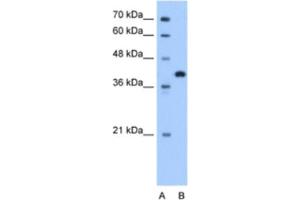 Western Blotting (WB) image for anti-Torsin Family 2, Member A (TOR2A) antibody (ABIN2463328) (TOR2A anticorps)