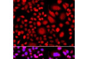 Immunofluorescence analysis of A549 cells using PRKAG3 Polyclonal Antibody (PRKAG3 anticorps)