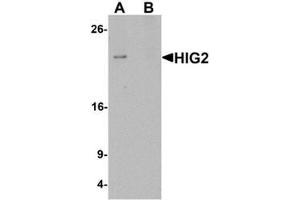 Western blot analysis of HIG2 in 3T3 cell lysate with HIG2 antibody at 1 ug/mL in (A) the absence and (B) the presence of blocking peptide. (HILPDA anticorps  (C-Term))
