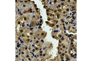 Immunohistochemical analysis of CALCOCO1 staining in human kidney formalin fixed paraffin embedded tissue section. (CALCOCO1 anticorps)