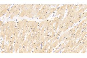 Detection of MYL3 in Human Cardiac Muscle Tissue using Polyclonal Antibody to Myosin Light Chain 3, Alkali, Ventricular, Slow Skeletal (MYL3) (MYL3/CMLC1 anticorps  (AA 5-181))