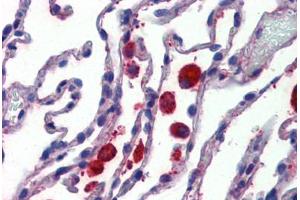 Anti-C14orf1 antibody  ABIN1048360 IHC staining of human lung. (C14orf1 anticorps  (Internal Region))