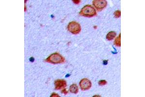 Immunohistochemical analysis of PRKD2 (pS876) staining in human brain formalin fixed paraffin embedded tissue section.