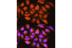 Immunofluorescence analysis of HeLa cells using B1 Rabbit pAb (ABIN1678629, ABIN3018003, ABIN3018005 and ABIN6220332) at dilution of 1:100. (ALDH1B1 anticorps  (AA 278-517))