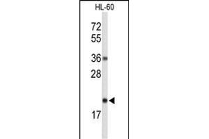 Western blot analysis of RNH2C Antibody (Center) (ABIN653251 and ABIN2842775) in HL-60 cell line lysates (35 μg/lane). (RNASEH2C anticorps  (AA 80-108))