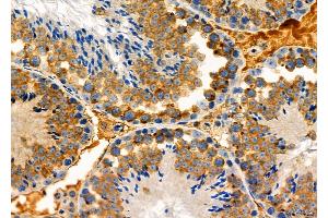 ABIN6261582 and ABIN6276939 at 1/100 staining Mouse testis tissue by IHC-P. (EPXH2 (C-Term) anticorps)