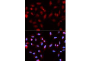 Immunofluorescence analysis of U2OS cells using BIRC5 antibody (ABIN5970737). (Survivin anticorps)