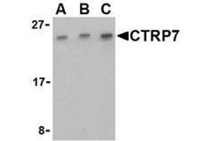 Western blot analysis of CTRP7 in 293 cell lysate with AP30258PU-N CTRP7 antibody at (A) 0.