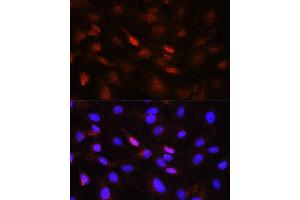 anti-Polo-Like Kinase 1 (PLK1) (AA 304-603) antibody