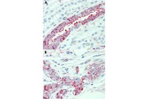 Immunohistochemical staining of human kidney (A) and human breast (B) with SLC4A2 polyclonal antibody . (SLC4A2 anticorps  (N-Term))