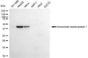 Western blotting analysis using Acrosomal vesicle protein 1 antibody (ABIN7797451).