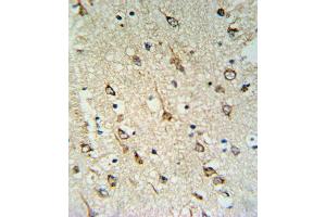 DNAJC6 Antibody (Center) (ABIN653940 and ABIN2843170) IHC analysis in formalin fixed and paraffin embedded human brain tissue followed by peroxidase conjugation of the secondary antibody and DAB staining. (DNAJC6 anticorps  (AA 254-281))