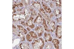 Immunohistochemical staining of human kidney with C10orf129 polyclonal antibody  shows moderate cytoplasmic positivity in renal tubules. (C10ORF129 anticorps)