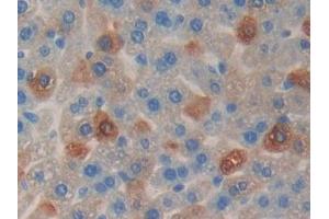 Detection of CCND2 in Mouse Liver Tissue using Polyclonal Antibody to Cyclin D2 (CCND2)