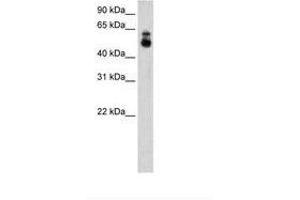 Image no. 2 for anti-Histone Deacetylase 9 (HDAC9) (C-Term) antibody (ABIN205000) (HDAC9 anticorps  (C-Term))