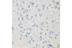 Immunohistochemistry of paraffin-embedded mouse brain using CD97 antibody at dilution of 1:100 (x40 lens).