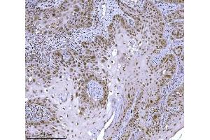 IHC analysis of JHDM3A/JMJD2A/KDM4A using anti-JHDM3A/JMJD2A/KDM4A antibody (ABIN7601534). (KDM4A anticorps  (AA 379-1064))