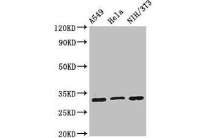 Western Blot Positive WB detected in: A549 whole cell lysate, Hela whole cell lysate, NIH/3T3 whole cell lysate All lanes: RPS2 antibody at 2 μg/mL Secondary Goat polyclonal to rabbit IgG at 1/50000 dilution Predicted band size: 32 kDa Observed band size: 32 kDa (RPS2 anticorps  (AA 2-61))