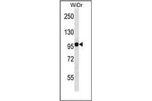 Western blot analysis of ITGB7 Antibody (C-term) in WiDr cell line lysates (35ug/lane). (Integrin beta 7 anticorps  (C-Term))