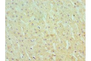 Immunohistochemistry of paraffin-embedded human liver tissue using ABIN7166367 at dilution of 1:100 (SERPINA1 anticorps  (AA 165-444))