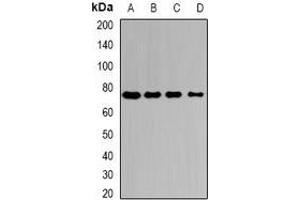 Western blot analysis of Citrin expression in HepG2 (A), Hela (B), mouse liver (C), mouse kidney (D) whole cell lysates. (slc25a13 anticorps)